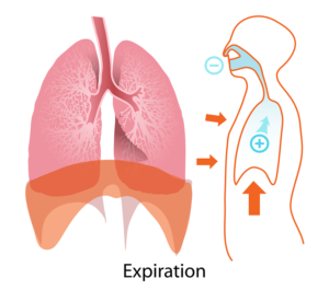 embolie pulmonaire