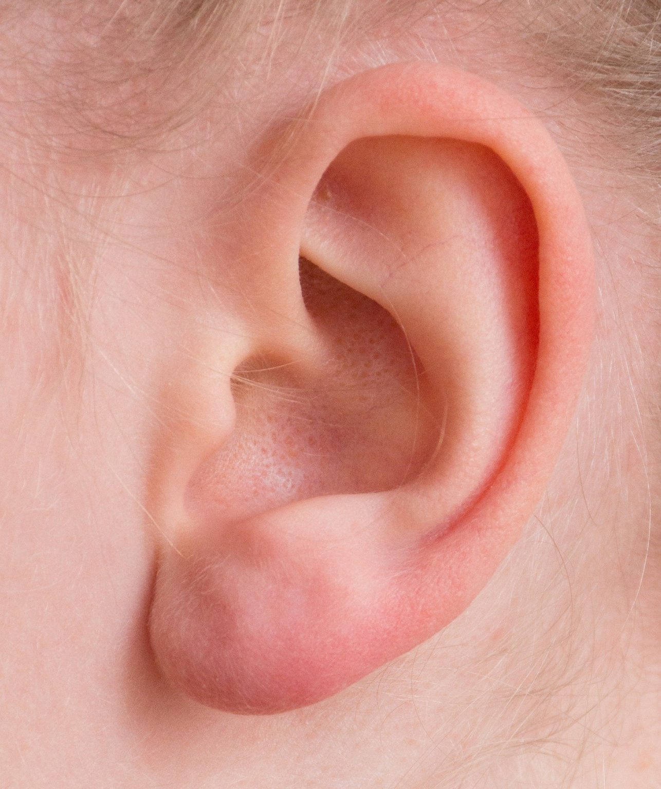 Boule Dure Dans Le Lobe De L Oreille boule derrière votre oreille - MHC Médical