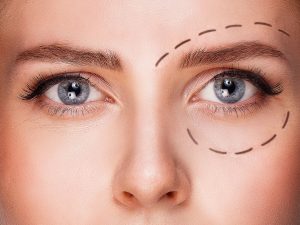 chirurgie esthétique des yeux